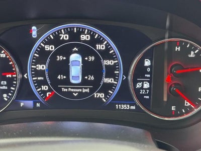 2025 Chevrolet Malibu 2LT